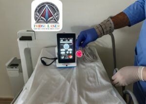 Diabetic Laser at Clinic